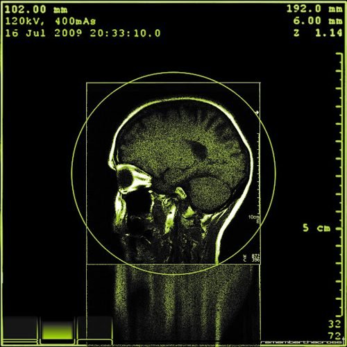 Portada de RUN